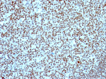Anti-Nucleolin antibody [NCL/902] used in IHC (Paraffin sections) (IHC-P). GTX34914
