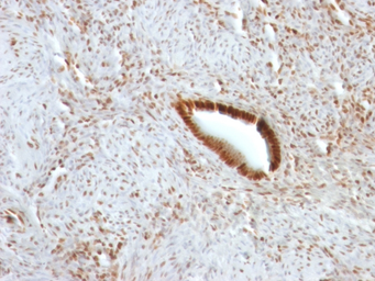 Anti-Nucleolin antibody [NCL/902] used in IHC (Paraffin sections) (IHC-P). GTX34914