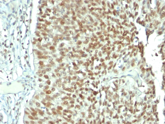 Anti-Nucleolin antibody [NCL/902] used in IHC (Paraffin sections) (IHC-P). GTX34914