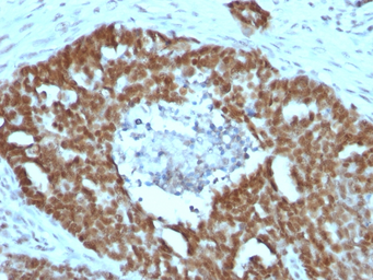 Anti-Nucleolin antibody [NCL/902] used in IHC (Paraffin sections) (IHC-P). GTX34914