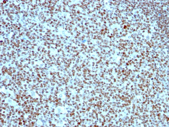 Anti-Nucleolin antibody [364-5] used in IHC (Paraffin sections) (IHC-P). GTX34916