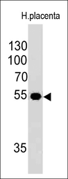 Anti-ODC antibody [ODC1/485] used in Western Blot (WB). GTX34919