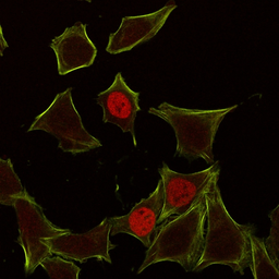 Anti-p21 Cip1 antibody [CIP1/823] used in Immunocytochemistry/ Immunofluorescence (ICC/IF). GTX34924