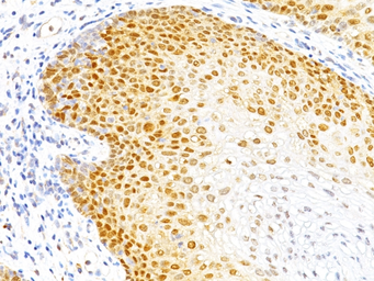 Anti-p27 Kip1 antibody [DCS-72.F6] used in IHC (Paraffin sections) (IHC-P). GTX34931