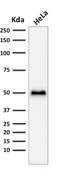 Anti-p53 antibody [TP53/1799R] used in Western Blot (WB). GTX34936