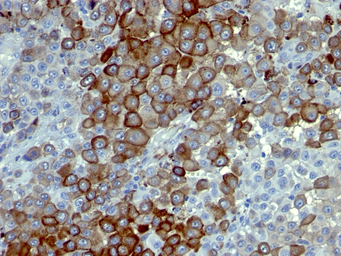 Anti-p75 NGF Receptor / CD271 antibody [NTR/912] used in IHC (Paraffin sections) (IHC-P). GTX34947