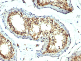 Anti-PAX7 antibody [PAX7/1187] used in IHC (Paraffin sections) (IHC-P). GTX34959