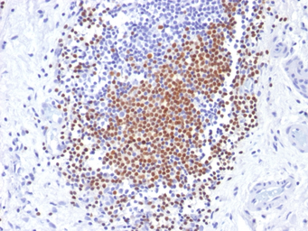 Anti-PAX8 antibody [PAX8/1492] used in IHC (Paraffin sections) (IHC-P). GTX34962
