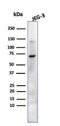Anti-Placental Alkaline Phosphatase antibody [ALPP/870] used in Western Blot (WB). GTX34972