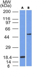 Anti-SOX10 antibody [SOX10/991] used in Western Blot (WB). GTX35083