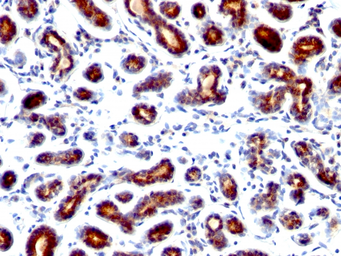 Anti-TFF1 antibody [TFF1/1091] used in IHC (Paraffin sections) (IHC-P). GTX35101