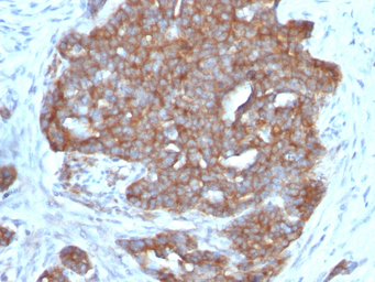Anti-TFF1 antibody [TFF1/1091] used in IHC (Paraffin sections) (IHC-P). GTX35101