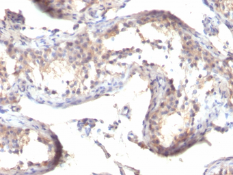 Anti-TGF alpha antibody [TGFA/1119] used in IHC (Paraffin sections) (IHC-P). GTX35107