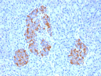 Anti-TNF alpha antibody [TNFA/1172] used in IHC (Paraffin sections) (IHC-P). GTX35131