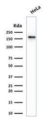 Anti-Topoisomerase II alpha antibody [TOP2A/1361] used in Western Blot (WB). GTX35137