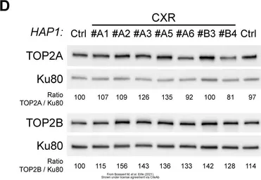 Anti-Topoisomerase II alpha antibody [TOP2A/1361] used in Western Blot (WB). GTX35137