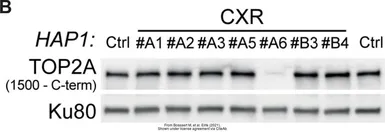 Anti-Topoisomerase II alpha antibody [TOP2A/1361] used in Western Blot (WB). GTX35137