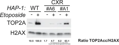 Anti-Topoisomerase II alpha antibody [TOP2A/1361] used in Western Blot (WB). GTX35137