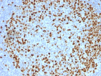 Anti-Topoisomerase II alpha antibody [TOP2A/1362] used in IHC (Paraffin sections) (IHC-P). GTX35138