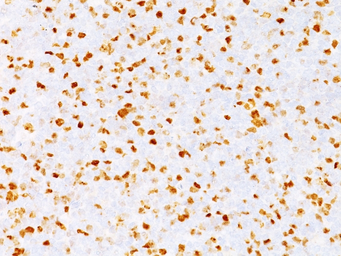 Anti-Topoisomerase II alpha antibody [TOP2A/1362] used in IHC (Paraffin sections) (IHC-P). GTX35138