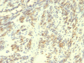 Anti-Transglutaminase 2 antibody [TGM2/419] used in IHC (Paraffin sections) (IHC-P). GTX35143