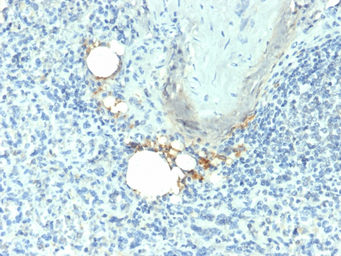 Anti-TRAP antibody [ACP5/1070] used in IHC (Paraffin sections) (IHC-P). GTX35145