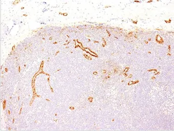 Anti-VWF antibody [VWF635] used in IHC (Paraffin sections) (IHC-P). GTX35166