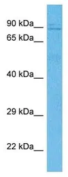 Anti-KIF3B antibody used in Western Blot (WB). GTX35189
