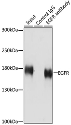 Anti-EGFR antibody used in Immunoprecipitation (IP). GTX35199