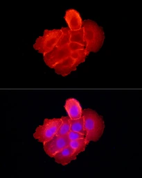 Anti-EGFR antibody used in Immunocytochemistry/ Immunofluorescence (ICC/IF). GTX35199