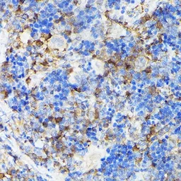 Anti-CSK antibody used in IHC (Paraffin sections) (IHC-P). GTX35201