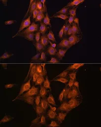 Anti-Merlin antibody used in Immunocytochemistry/ Immunofluorescence (ICC/IF). GTX35202
