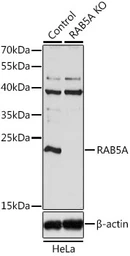 Anti-RAB5A antibody used in Western Blot (WB). GTX35207