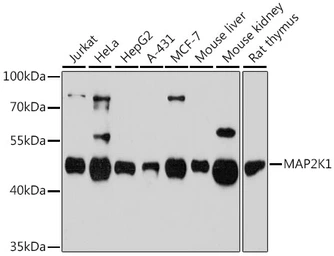 Anti-MEK1 antibody used in Western Blot (WB). GTX35212