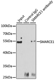 Anti-BAF57 antibody used in Immunoprecipitation (IP). GTX35217
