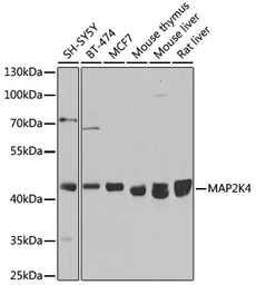Anti-SEK1 / MKK4 antibody used in Western Blot (WB). GTX35224