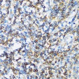 Anti-ARHGEF1 antibody used in IHC (Paraffin sections) (IHC-P). GTX35236
