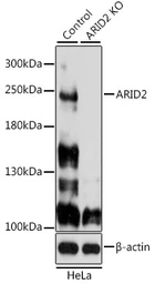Anti-ARID2 antibody used in Western Blot (WB). GTX35240