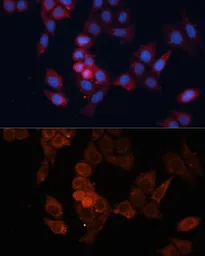 Anti-HSP27 antibody used in Immunocytochemistry/ Immunofluorescence (ICC/IF). GTX35243