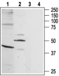 Anti-Bradykinin B1 receptor antibody used in Western Blot (WB). GTX35257