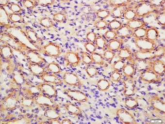 Anti-FAP antibody used in IHC (Paraffin sections) (IHC-P). GTX35261