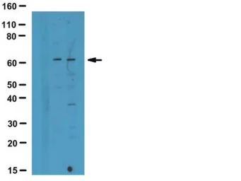 Anti-CaMKII (oxidized) antibody used in Western Blot (WB). GTX36254