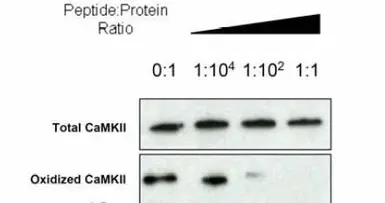 Anti-CaMKII (oxidized) antibody used in Western Blot (WB). GTX36254