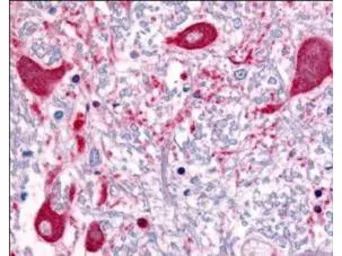 Anti-ROBO1 antibody used in IHC (Paraffin sections) (IHC-P). GTX36928