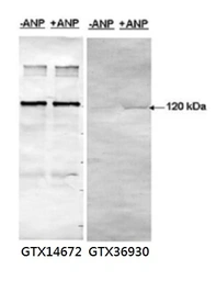 Anti-PDE5A (phospho Ser 92) antibody used in Western Blot (WB). GTX36930