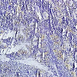 Anti-LIGHT antibody used in IHC (Paraffin sections) (IHC-P). GTX37328