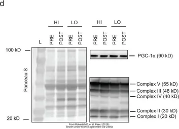 Anti-PGC1 alpha antibody used in Western Blot (WB). GTX37356