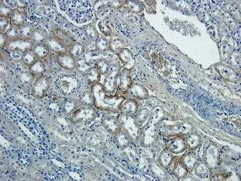 Anti-NTCP antibody used in IHC (Paraffin sections) (IHC-P). GTX37362