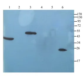 Anti-IL11 antibody used in Western Blot (WB). GTX37407