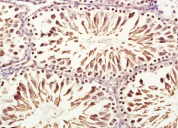 Anti-VWCE antibody used in IHC (Paraffin sections) (IHC-P). GTX37414